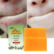 DEVNEN Turmeric Soap: Whitening, Acne Treatment, Anti-Aging & Smooth Skin