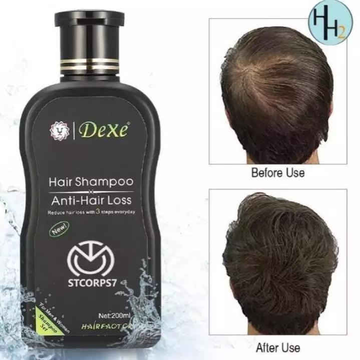 Dexe Organic Hair Growth Anti Hair Loss Shampoo Hair Grower