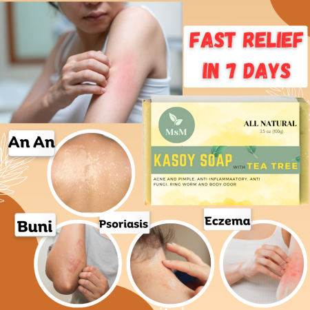 An An Remover Kasoy Soap for Itchy Skin and Acne