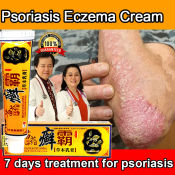 Atoderma Eczema Cream - Effective Treatment for Psoriasis and Itch