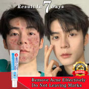 Pimple Removal Gel by 