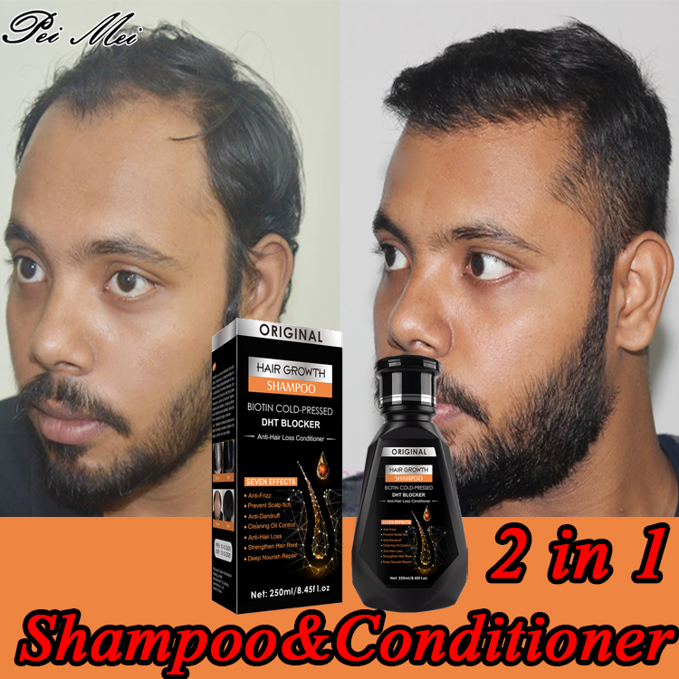 Delivery in 3 day】PEIMEI Hair Growth Shampoo hair grower shampoo Shampoo  For All Types Of Hair, Anti Hair Fall and Hair Grower Shampoo Thinning Hair  Treatment for Anti Hairloss and Anti Hairfall