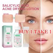 Pimple Warrior Acne Drying Lotion - Spot Treatment Care