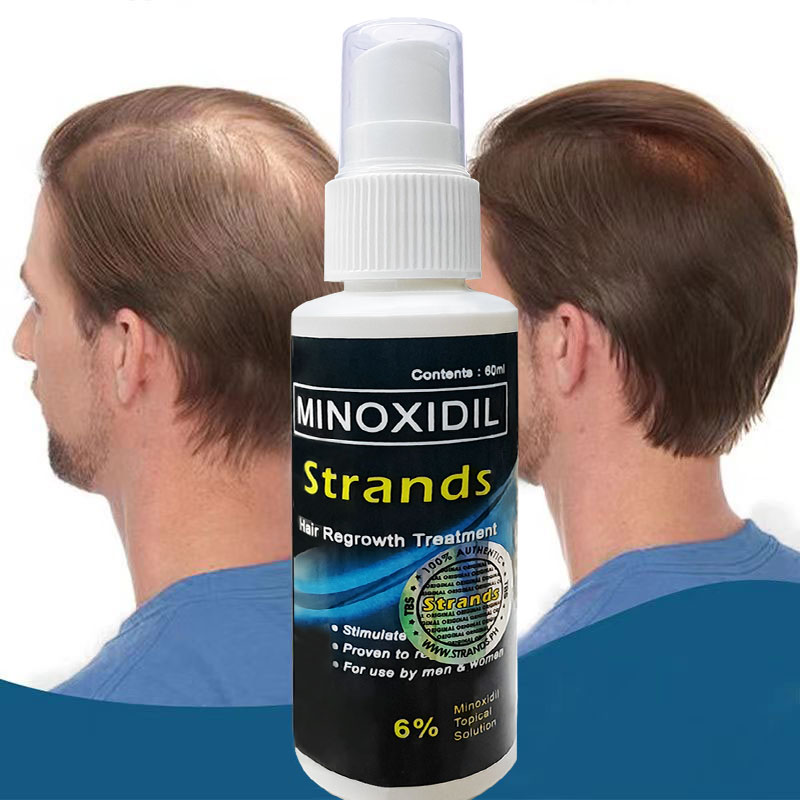 Minoxidil Strands 6% Hair Lo...