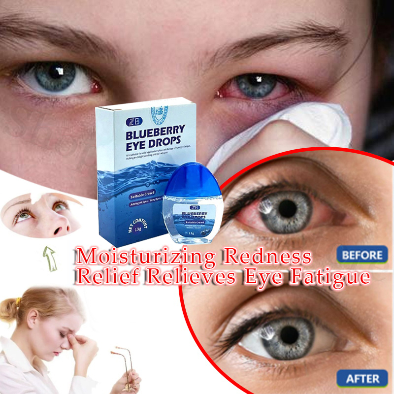 Blueberry Eye Drop Relieves Red Eyes Discomfort Visual, 48% OFF