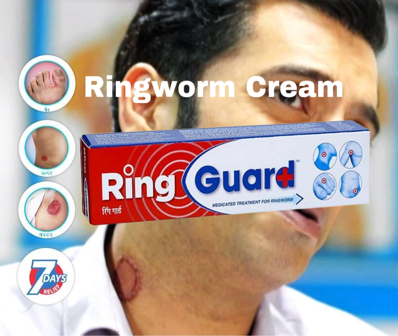 Ring Guard Cream, 20g Medicated Treatment for Ringworm