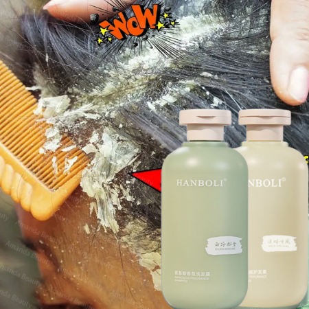 Nakami Anti Dandruff Shampoo - 300ml