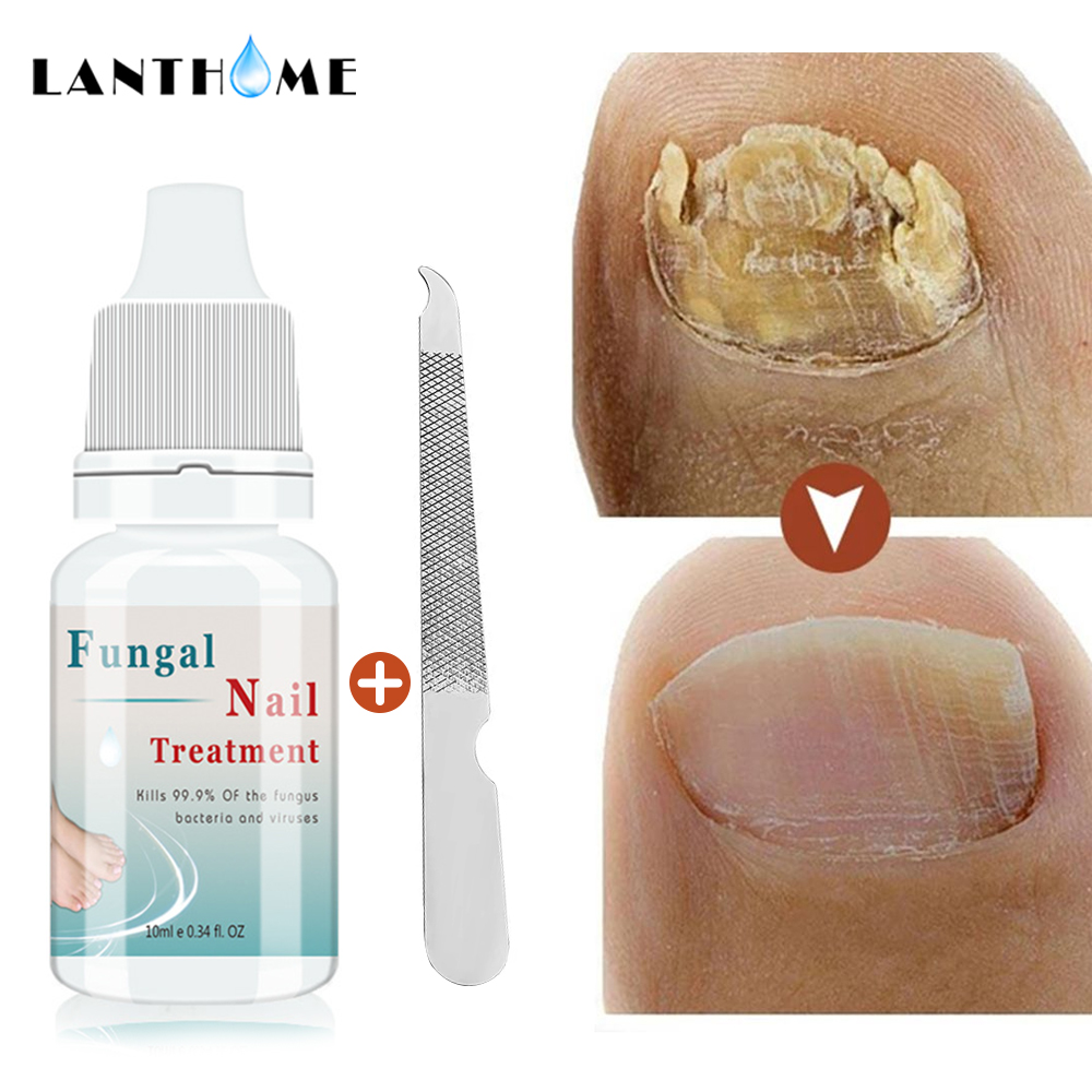 lanthome Nail Repair Essence Serum Fungal Nail Treatment Anti Fungal Nail Solution Hand Foot