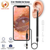 Visual Ear Cleaner Endoscope by Smart, Ear Wax Remover