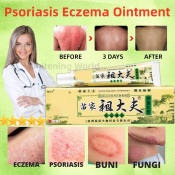 ZDF Chinese Herbal Psoriasis Cream