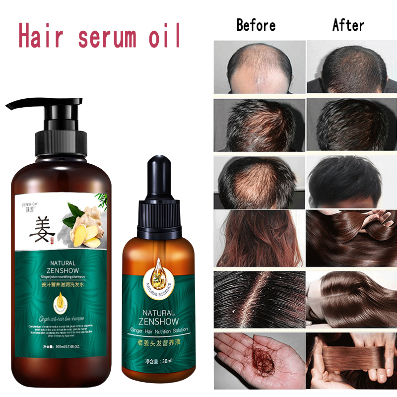 Hair Serum Hair Grower Fast Long Hair Treatment Minoxidil Hair 30ml Grower  Castor Oil For Hair Growth | Lazada PH