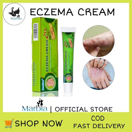 Sumifun Eczema Treatment Cream: Effective Relief for Itchy Skin