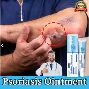 Eczema & Psoriasis Treatment Ointment - Fast and Effective
