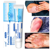 100% Original Psoriasis Cream Psoriasis Eczema Pruritus Itchiness Treatment Authentic Doctor recommended anti fungal cream zudaifu ointment psoriasis ointment ringworm and fungal ointment psoriasis cream mupirocin ointment eczema