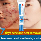Pimple Eraser Acne Treatment Cream 