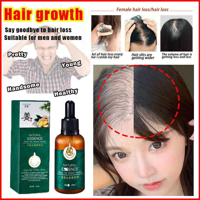 10/30ml Days Fast Hair Growth Essence Oil Hair Growth Serum Nourishing  Soften Treatment Hair Loss Repair Damaged Hair Organic Hair Loss Product  Series AliExpress | Fast Hair Growth Serum Ginger Hair Loss