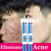 Pimple Eraser Acne Treatment Cream by 