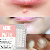 Acne Treatment Stickers - Waterproof Pimple Patch by 
