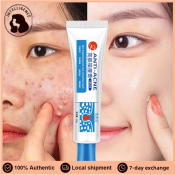 IE Acne Treatment Cream - 100% Effective, 25g