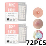Hydrocolloid Acne Pimple Patches - 72PCS, Waterproof, Effective