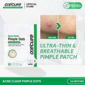 OXECURE Acne Clear Pimple Dots