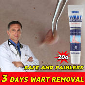 Safe Painless Wart Removal Ointment by 