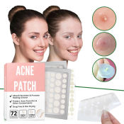 72PCS Waterproof Acne Pimple Patches - Effective Pimple Removal