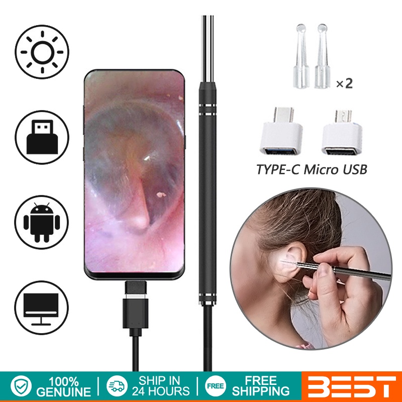 best ear endoscope camera