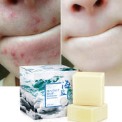 Sea Salt Whitening Soap for Acne Treatment and Skin Improvement