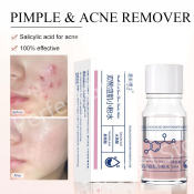 Salicylic Acid Acne Serum - Pimple & Scar Treatment 10ml