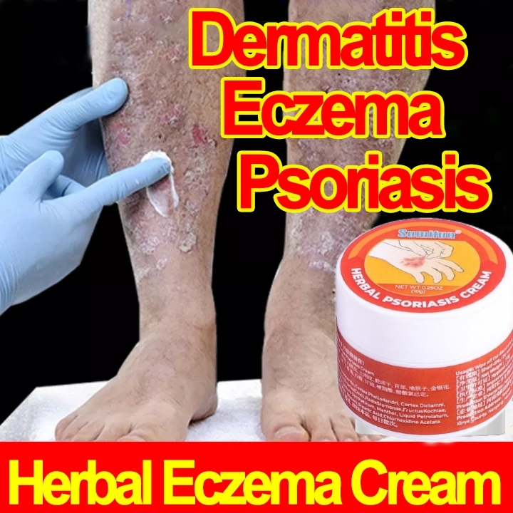 Quick Relief Itching Eczema Treatment Cream by 