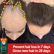 Ginger Hair Growth Serum - Fast Grower by 