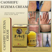 CAOSHIFU Eczema Psoriasis Treatment Cream - Allergy Relief Ointment