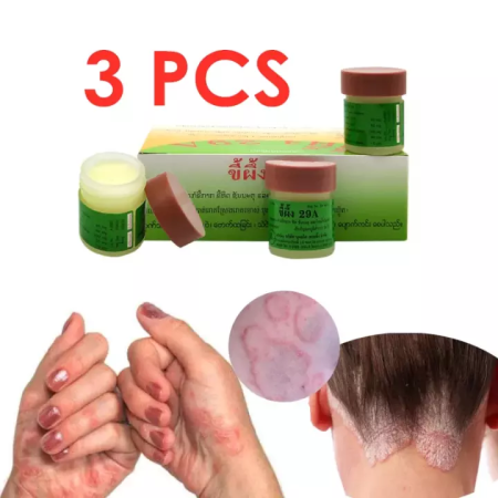 Tattie 3Pcs Natural Cream for Psoriasis, Eczema, and Ringworm