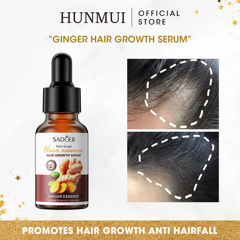 Original Ginger Hair Growth Serum Anti Hairfall Prevent Alopecia Hair Loss  Treatment Hair Grower Essence 30ml | Lazada PH