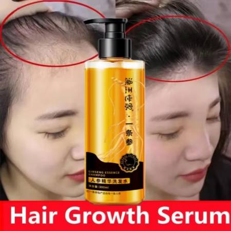 CINDYNAL Ginseng Shampoo for Hair Regrowth & Anti-Dandruff 300ml