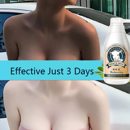 300ML Whitening Lotion Goat Milk Body Lotion Moisturizing Lotion Chicken Skin Body Cream Whitening Moisturizing Anti-Aging Smoothing Mite Removal Skin Care Remove Dry Scaled Skin After Sun Repair Lotion