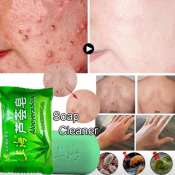Aloe Vera Soap: Acne Pimple Remover and Body Cleaner