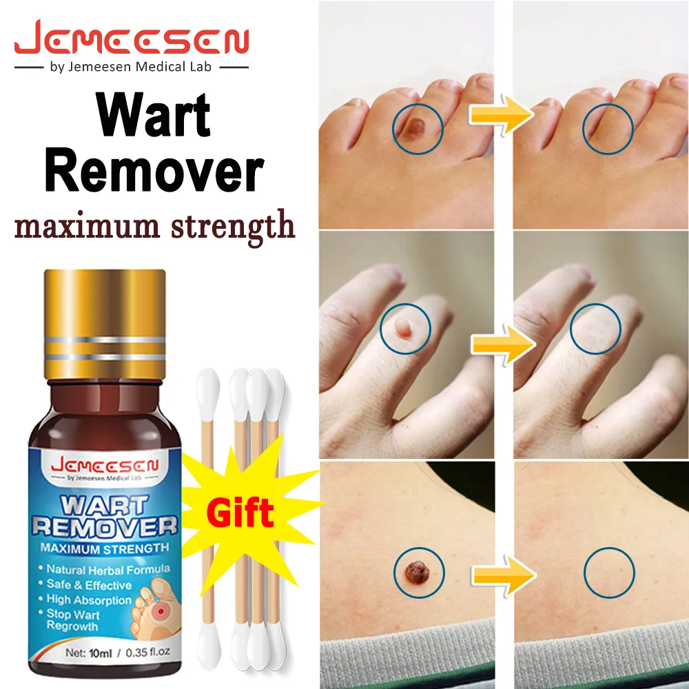 Share more than 143 nail polish remover for warts best noithatsi.vn