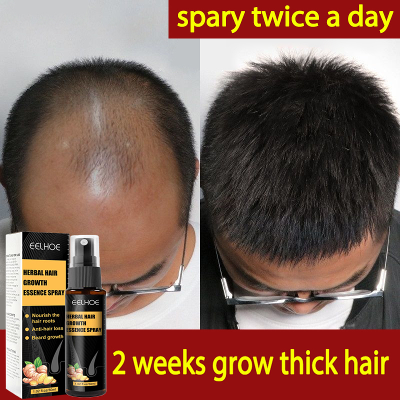 ⚡5 Days Fast Hair Growth⚡EELHOE Hair Growth Spray 30ML Fast Powerful Hair Grower Hair Care 100% Pure Natural Treatment Hair Loss Hair Grower for Men and Women hair grower for men original ⚡5 Days Fast Hair Growth⚡EELHOE Hair Growth Spray 30ML Fast Powerful Hair Grower Hair Care 100% Pure Natural Treatment Hair Loss Hair Grower for Men and Women hair grower for men original 