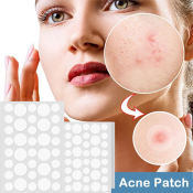 Buutersy Salicylic Acne Pimple Patch - Waterproof Hydrocolloid Stickers