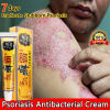 Sumifun Eczema Treatment Cream - Relief for Itchy, Allergic Skin