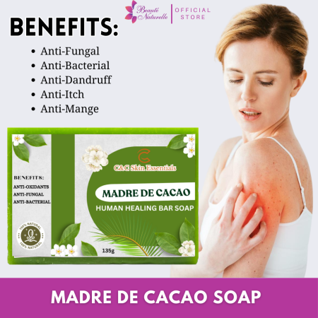 Madre De Cacao: 100% Natural Antibacterial Soap for Scabies Relief