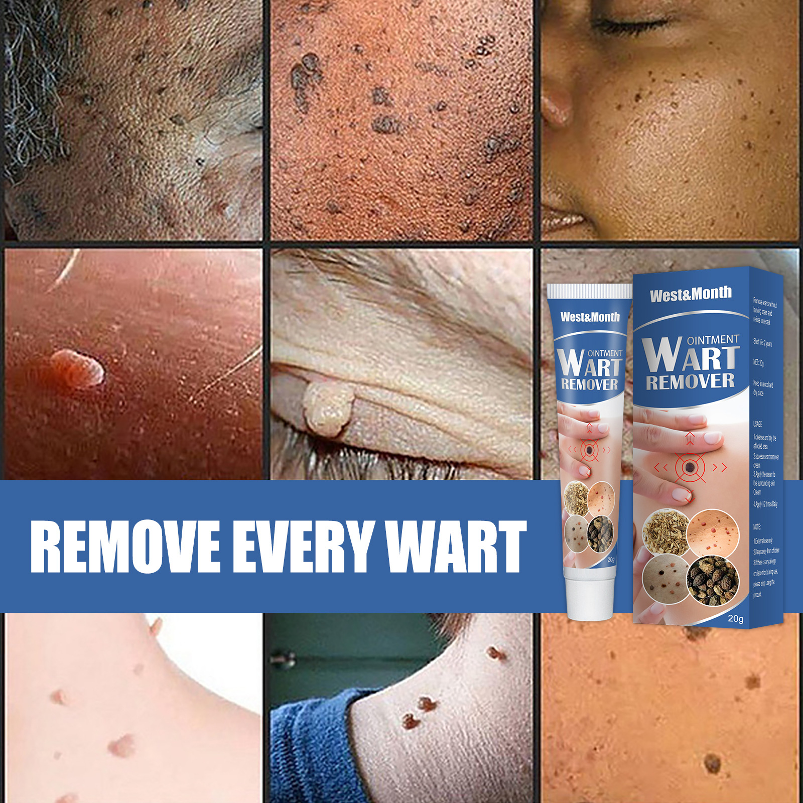 20g Against Genital Wart Cream Vulva Human Papillomavirus Mole Fast Remove Foot Corn Warts 1362