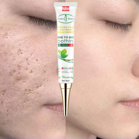 Acne cream pimple eraser pimple marks remover acne Removes Dark Spots Skin Renewal Anti Aging Cream for Younger Smoother Blemish Free Dark Spot Corrector Powerful Anti Acne and Anti Wrinkle Formula Facial Cream