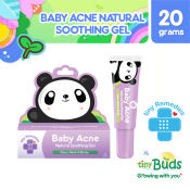 Tiny Buds Baby Acne Natural Soothing gel