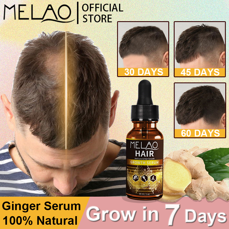 MELAO Natural Hair Growth Serum Organic Nourishing Scalp Ginger Fast Hair  Grower Essential Oil Hair Care Unisex 30ml | Lazada PH