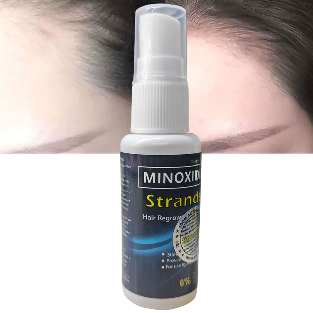 Men Women Hair Growth Essence Hair Loss Treatment Minoxidil