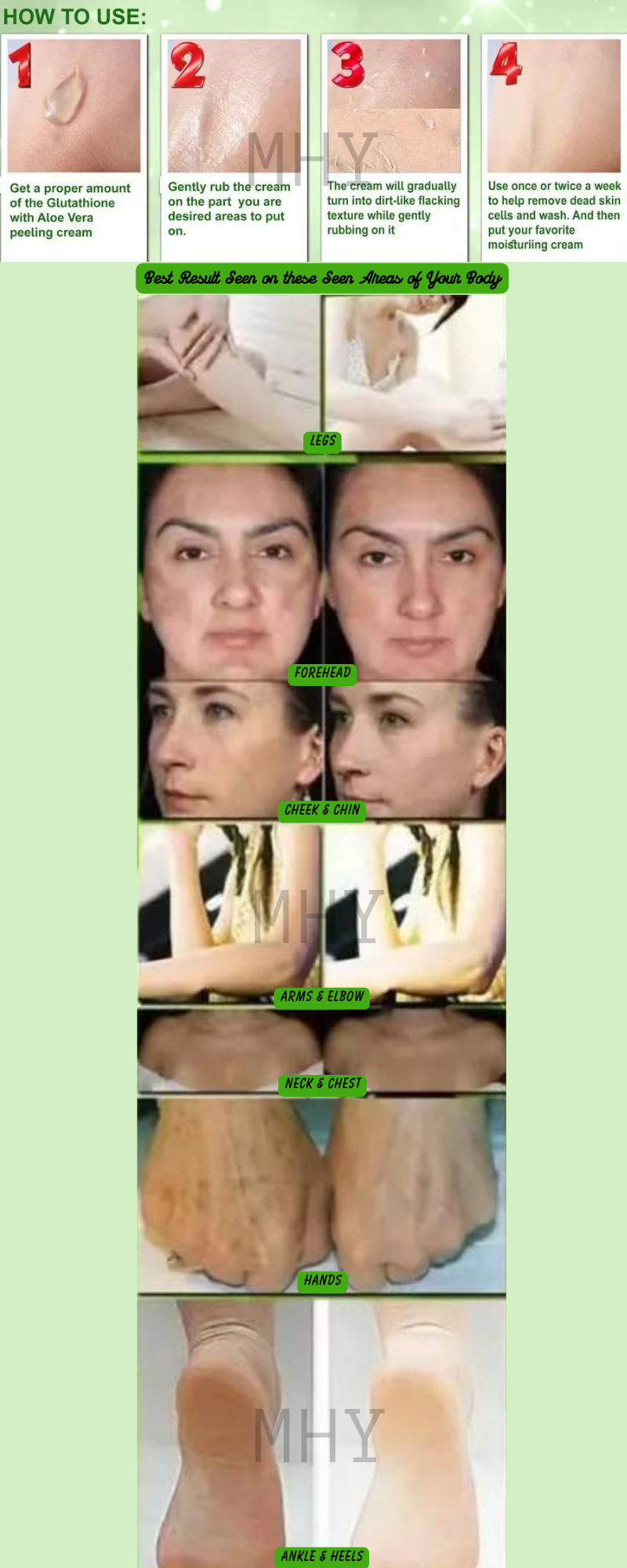 benefits of igf-1 lr3 igf 1-lr3 IGF-1 LR3 in Aesthetic and Anti-Aging Medicine: Benefits and Risks benefits of igf-1 lr3 igf 1-lr3 IGF-1 LR3 in Aesthetic and Anti-Aging Medicine: Benefits and Risks