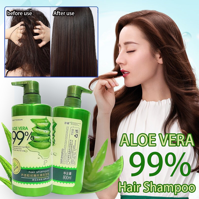 7 Benefits of Aloe Vera For Hair & 14 Common Hair Care Remedies Using Aloe  Vera - PG Shop – Owned by BGDPL, Authorised P&G Distributor